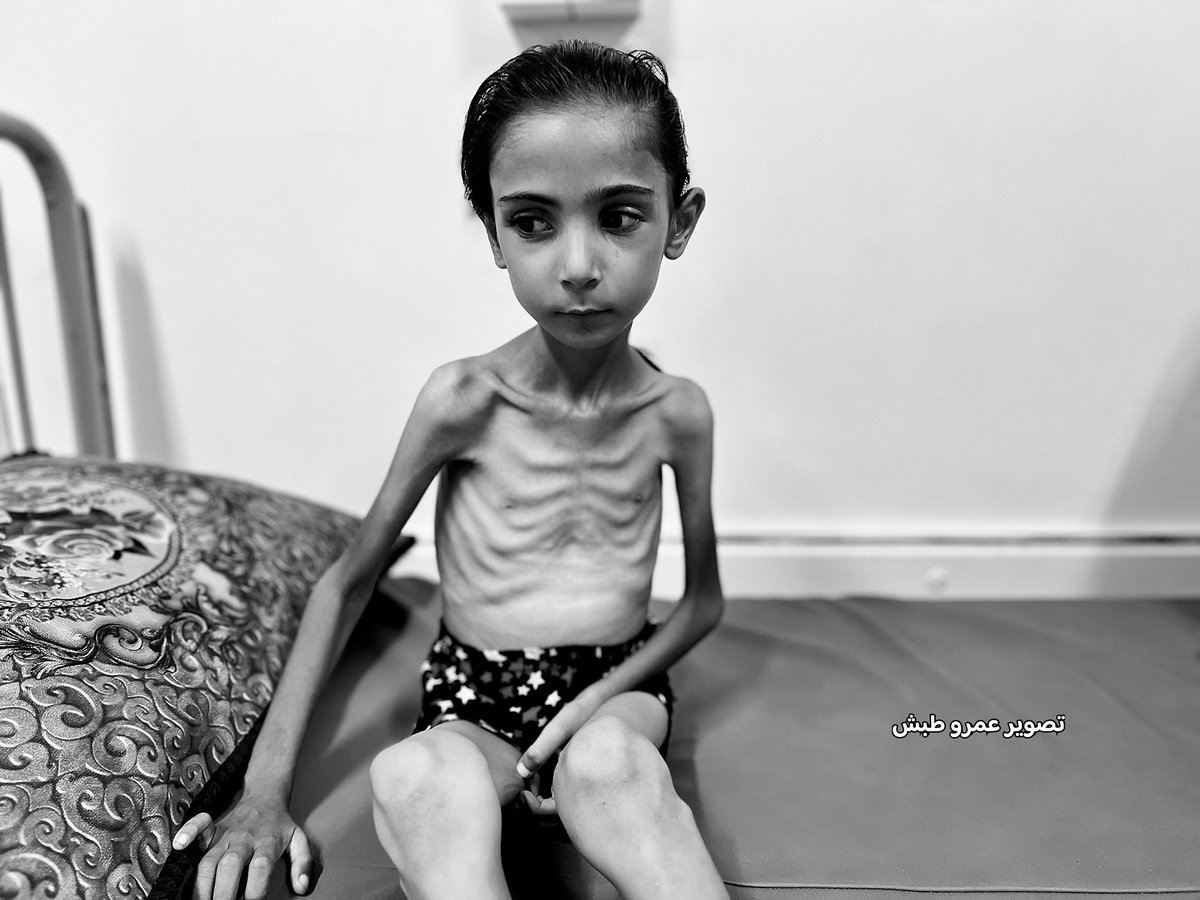 RamAbdu's tweet image. Breaking: Since this morning, 3 children from Gaza have died due to Israeli-induced starvation.
The death toll is expected to rise noticeably in the coming hours if sufficient and urgent aid is not allowed in.