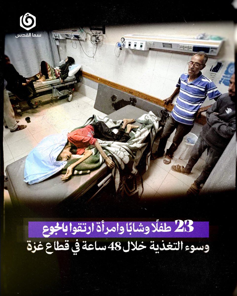 samaqudspl's tweet image. هذا ما وصل المستشفيات فقط، ولا تشمل هذه الأرقام من ارتقى في بيته، وأنهك الجوع أهله ولم يجدوا في أنفسهم طاقة لحمله إلى المستشفى، فبكوا بجانبه ..
ننشر هذه الإحصائية والساعة لم تتجاوز الواحدة ظهرًا بتوقيت القدس المحتلة، ونحن نعلم أن الرقم خلال ساعات سيزداد، لأن المجاعة مستمرة!