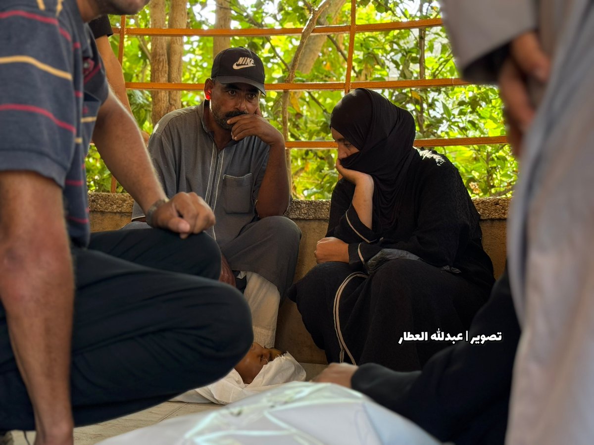 abdallahatar's tweet image. الطفل عبد الجواد الغلبان عمره 14 سنة توفي بسبب سوء تغذية حاد .