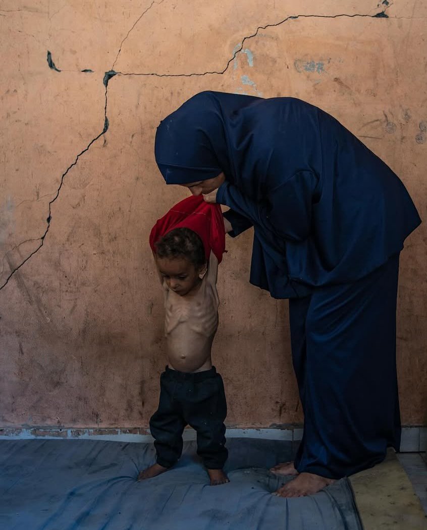 marinamkadi's tweet image. One of the saddest pages of humanity is currently being written in Gaza. Children are dying of hunger, not because there is no food, but because the Israeli government is using starvation as a weapon against the civilian population.
For as long as children suffer, we cannot talk…