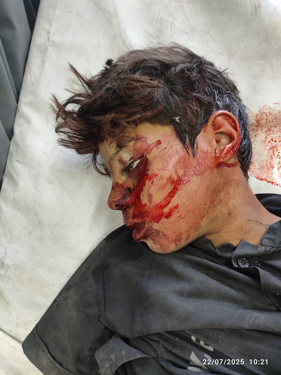 RamAbdu's tweet image. An unidentified child who arrived at the Sheikh Radwan clinic from the Bir al-Naja area was killed by Israel while searching for food.