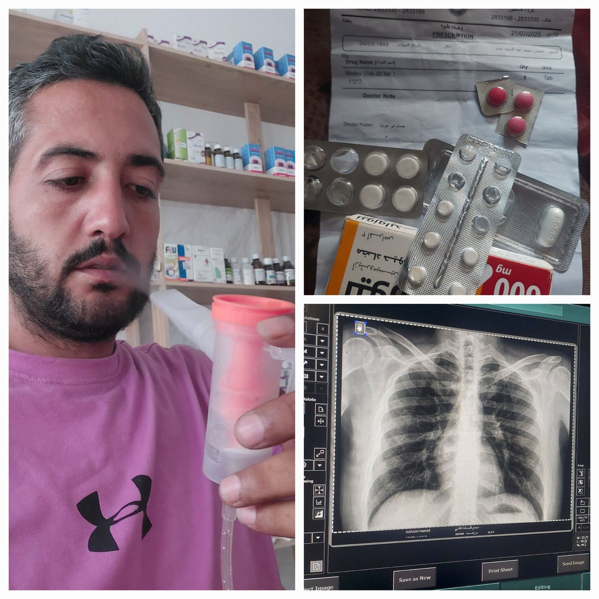 MohsenHamad0's tweet image. 🙏 I Appeal to Your Kind Hearts 🙏
I am sick 💔 and my body is completely exhausted 🛌.
I went to the hospital 🏥 and did some tests 🧪. It turns out I need urgent treatment 💉 that is very expensive 💸.
I can no longer walk 🚷, and my family and I are living in extremely…
