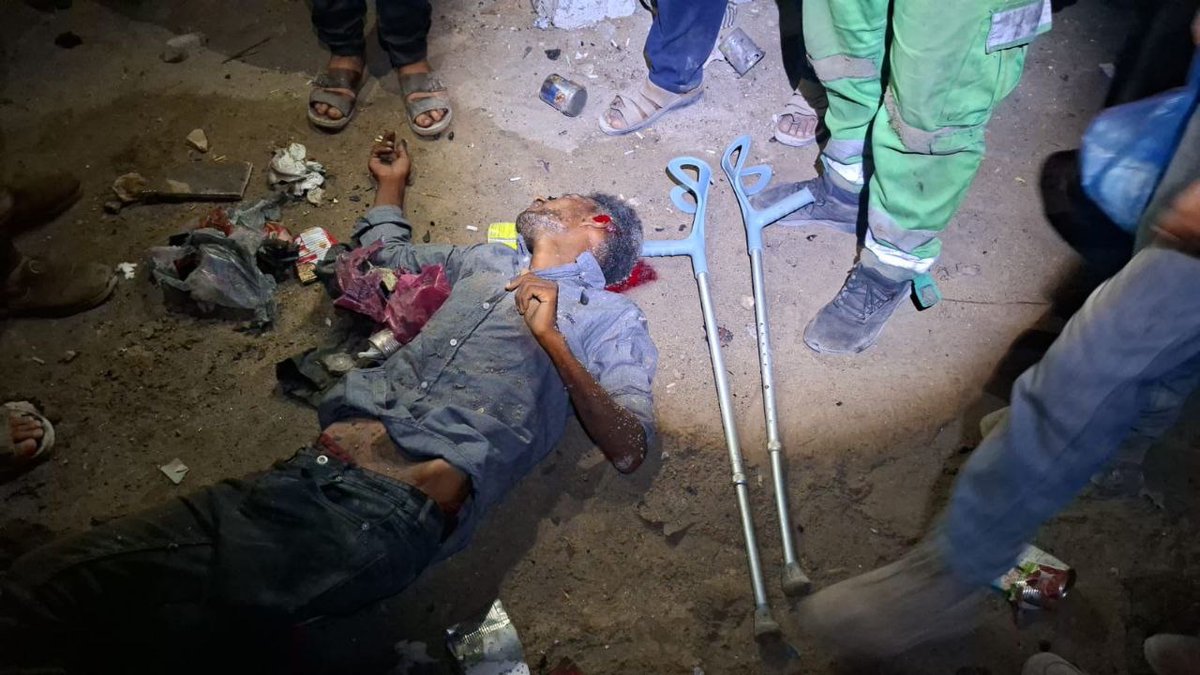 wissamshabat's tweet image. 14 martyrs and more than 25 injuries as a result of the occupation's bombing of the tents of the displaced on the northern beach west of Gaza City.