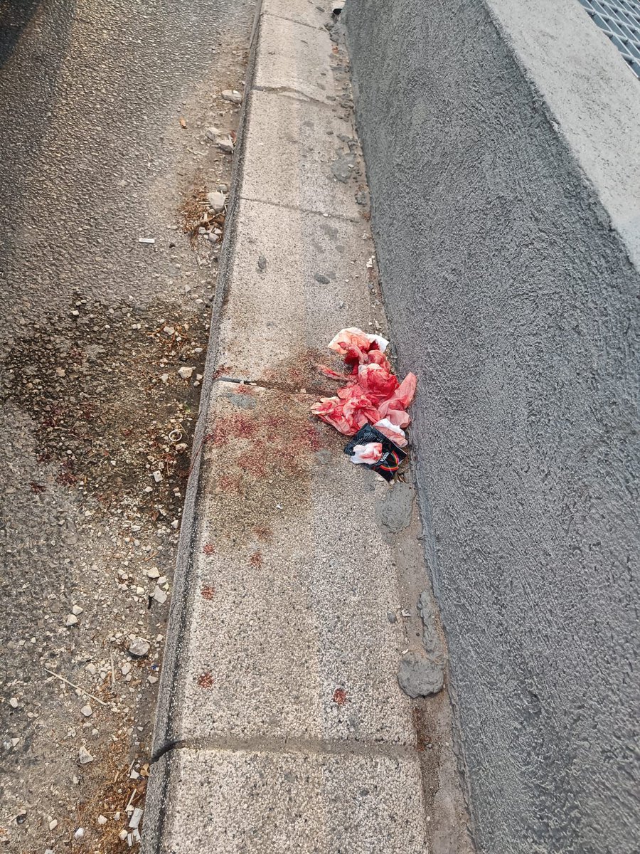 AtzurimHafganot's tweet image. עידכון בוקר-
המפגין שהותקף אתמול ע״י האופנוען הצעיר מבני ברק הגיע לתחנת המשטרה להגיש תלונה
בליווי עו״ד גבי לסקי ממערך עוטף עצורים.
הוא עדיין עם סימני חבלה ניכרים לאחר לילה ארוך במיון.
התוקף, בילה את הלילה במעצר ויובא בפני שופט.
באשר לאירוע הדריסה של המרצדס השחורה עדי ראייה דיווחו…