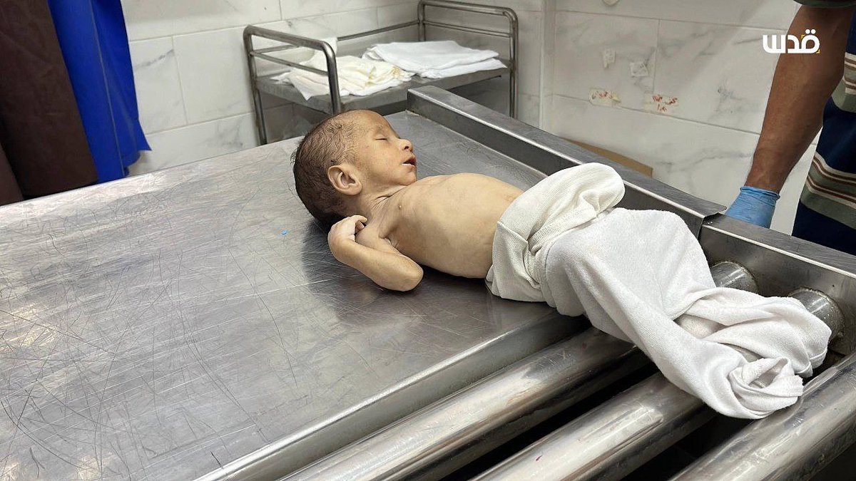 adinitay's tweet image. #מעורבים_בעל_כורחם
יוסף מחמד אל ס׳פאדי. היה ואיננו
בן 40 יום.
22.7.25 מת מרעב. ביהח אל שיפאא העיר עזה.