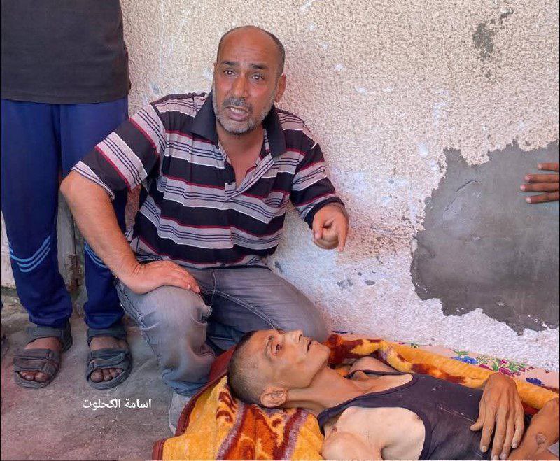 doamuslims's tweet image. A starved Palestinian man, Ahmad Al-Hasant, was announced dead this morning at Shuhada Al-Aqsa Hospital in central #Gaza due to severe malnutrition.