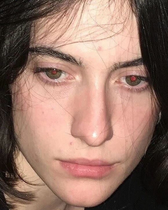 rogue's tweet image. The red-eye effect in photography is the common appearance of red pupils in color photographs which occurs when using a photographic flash at low lighting