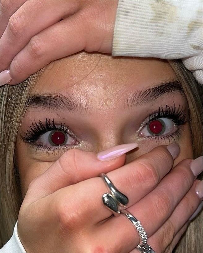 rogue's tweet image. The red-eye effect in photography is the common appearance of red pupils in color photographs which occurs when using a photographic flash at low lighting