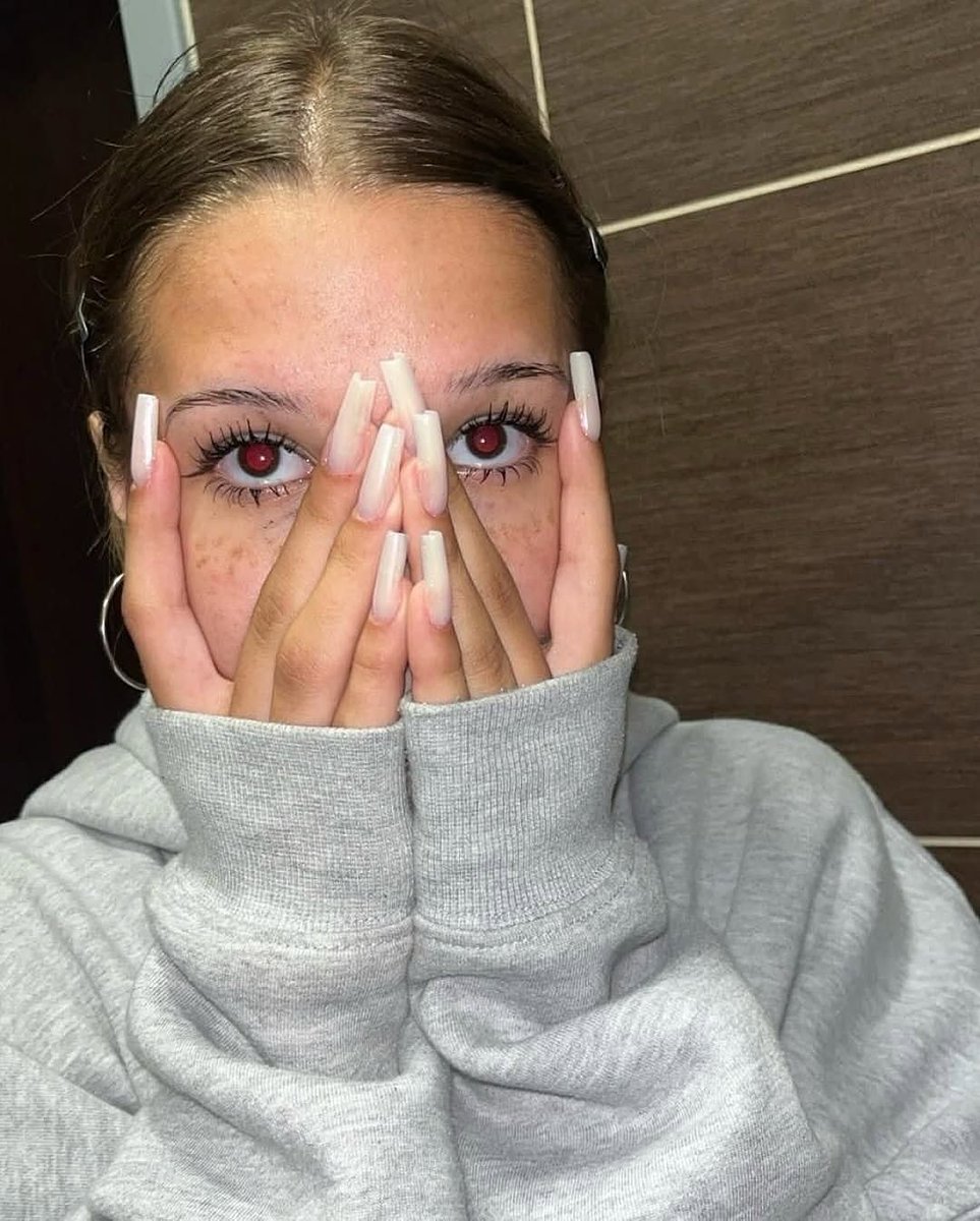 rogue's tweet image. The red-eye effect in photography is the common appearance of red pupils in color photographs which occurs when using a photographic flash at low lighting