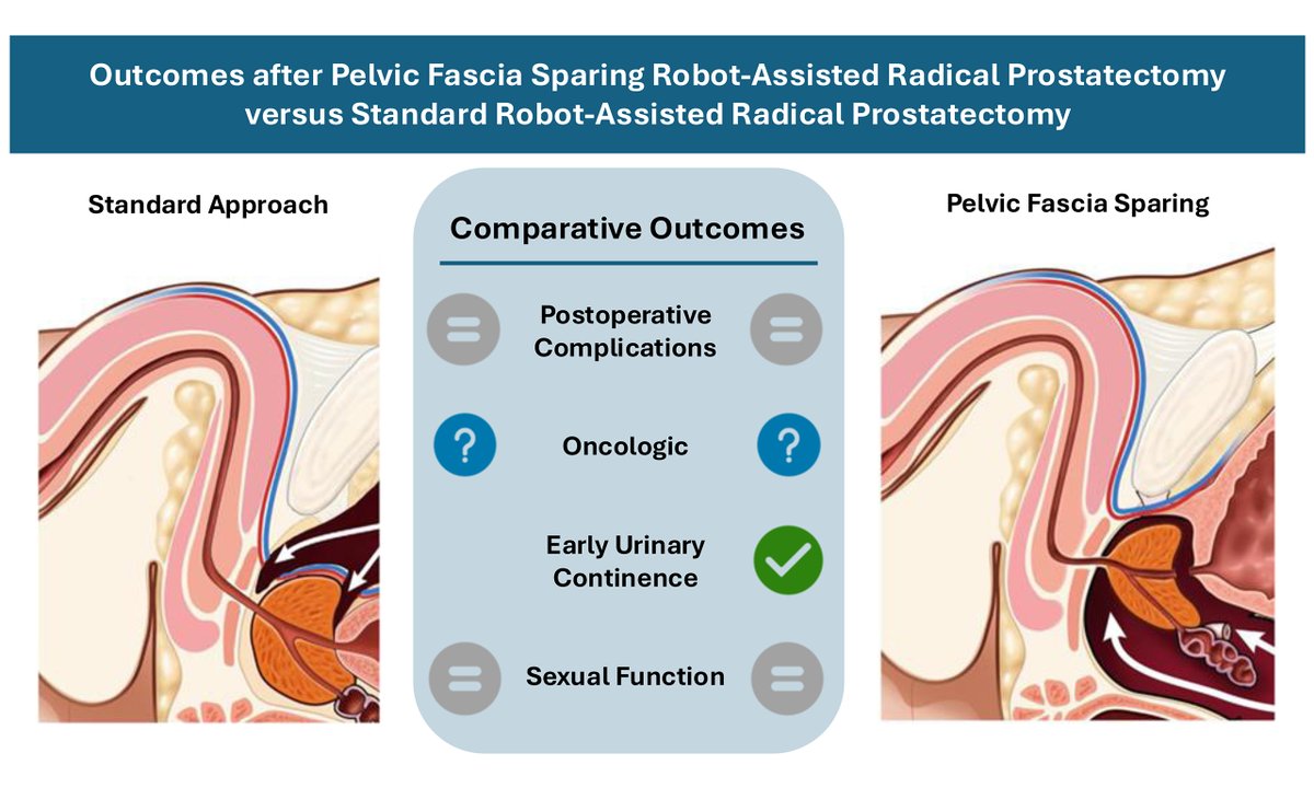 🚀 New in Mini-invasive Surgery!
⚙️ Pelvic fascia-sparing vs standard robotic prostatectomy
✨ Better urinary continence &amp; QoL by fascia preservation
⚖️ Anatomy, technique &amp; oncologic safety discussed
👩‍⚕️ Kodres-O’Brien et al.
🔗 oaepublish.com/articles/2574-…