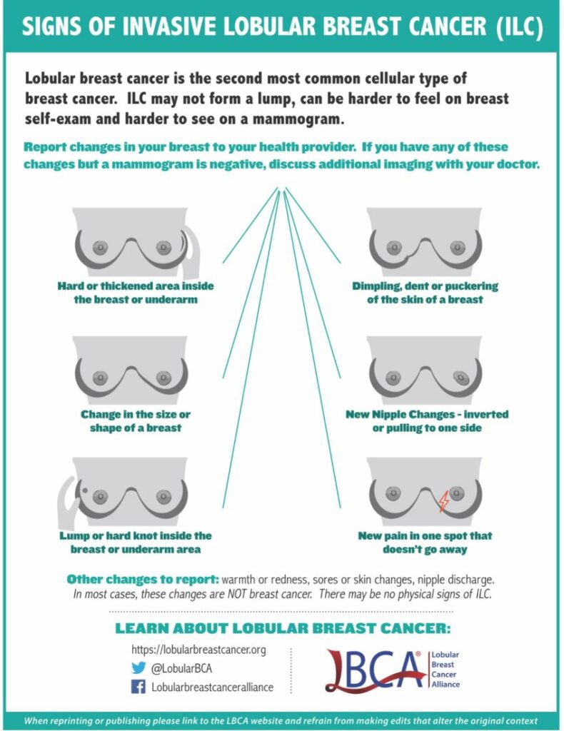 DrNighatArif's tweet image. Join us today on @bbc5live for That Time Of The Month as we discuss Lobular #BreastCancer with special guest Darlaine Honey, co-founded Lobular Breast Cancer UK (LBCUK), Professor Rob Clarke and Tristan Lorraine, Lobular Moon Shot Project.
Hosted by the incredible @TVNaga01 Drโฆ