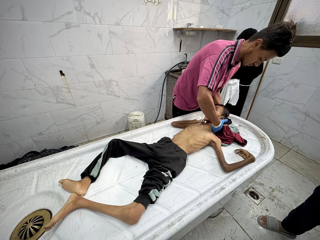GozukaraFurkan's tweet image. Another children murdered in most inhumane way by Israel : starvation
