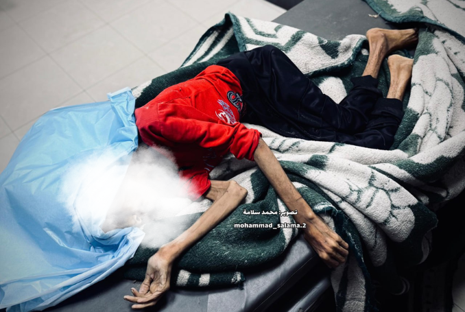 PalestineChron's tweet image. Raheel Mohammed Rasras, a 32-year-old Palestinian woman with special needs, passed away on Monday evening at the Nasser Medical Complex in Khan Yunis, southern Gaza, after a prolonged and painful battle with severe malnutrition.
palestinechronicle.com/raheel-rasras-…