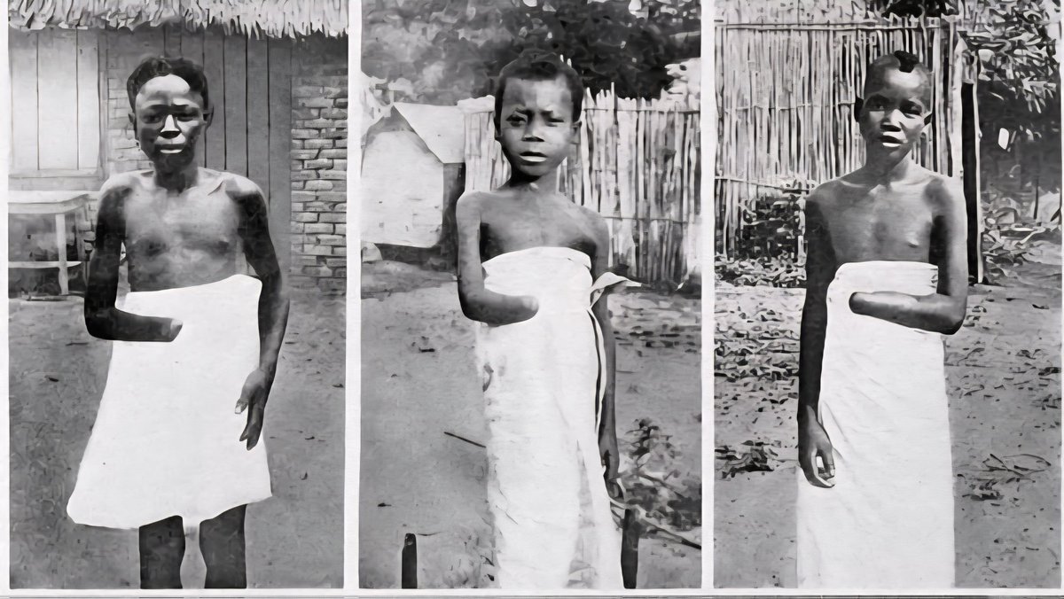amramleifer's tweet image. King of Belgium denounces the humanitarian situation in Gaza.
Coming from that family, I guess that he would prefer something more graphic.
