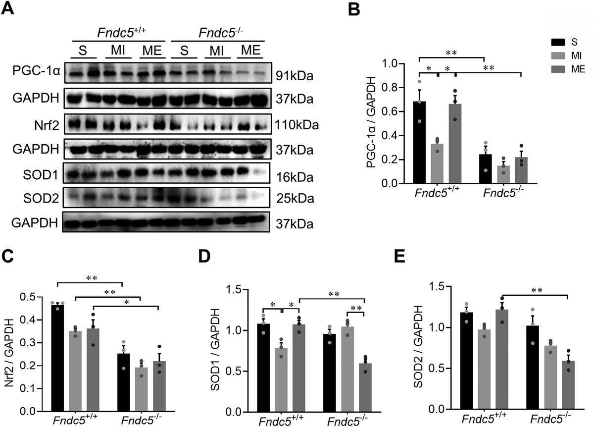 JPBY_official's tweet photo. Role of Irisin in exercise training-regulated endoplasmic reticulum stress, autophagy and myogenesis in the skeletal muscle after myocardial infarction https://t.co/8U2cfaaDFj
@SNNUChina
#Myocardial_infarction #Exercise_training #Irisin
#Skeletal_muscle https://t.co/GlsiDr95Zd