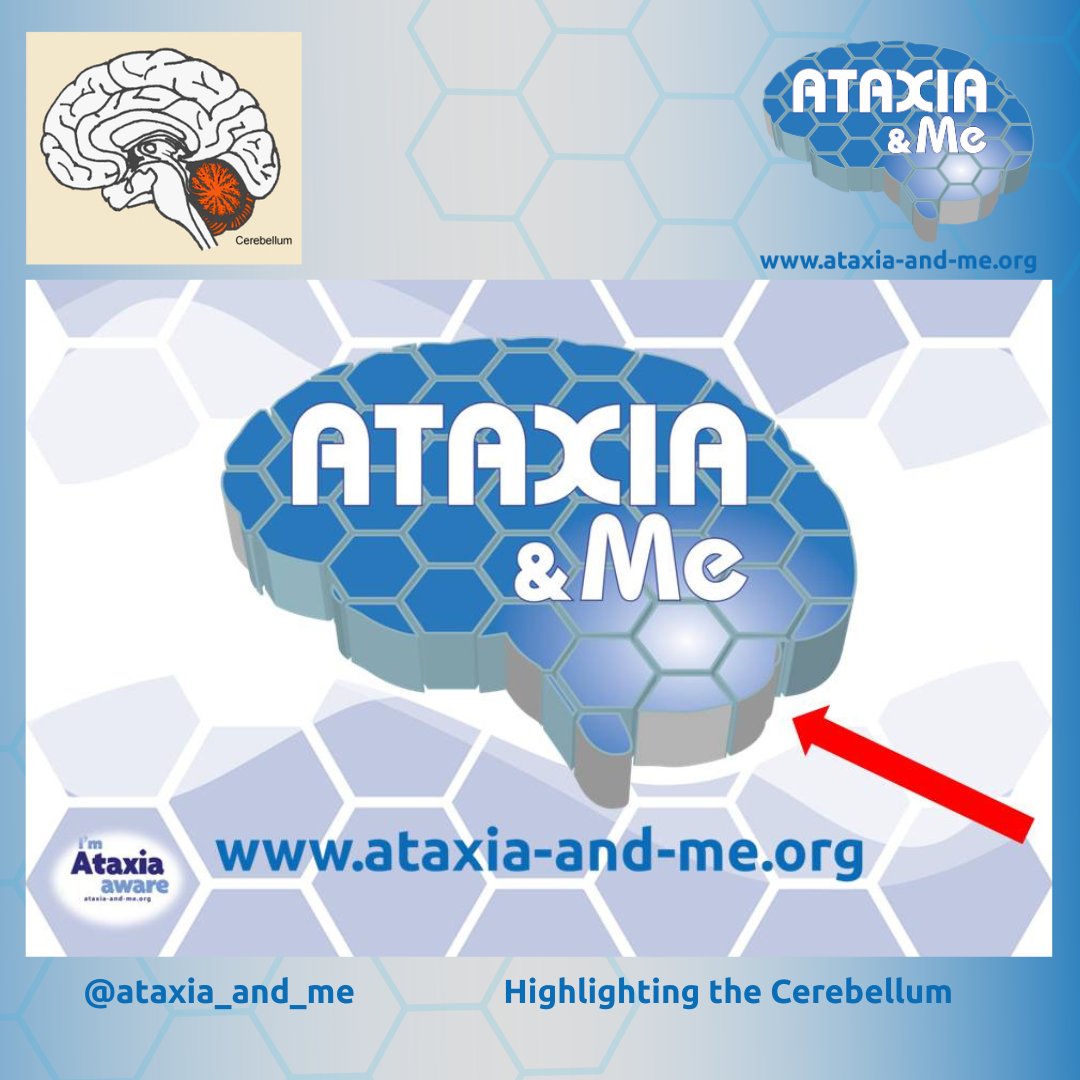 Ataxia_and_Me's tweet image. What does our #Brain #Logo show ?
It shows the #Cerebellum (the faulty part)Checkout ataxia-and-me.org
and #SocialMedia channels @ataxia_and_me to find out more.
#StrongerTogether #Cerebellum #PatientsHelpingPatients, #WorldBrainDay
