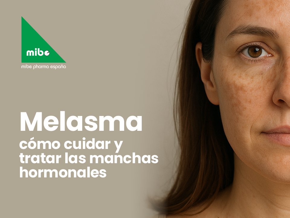 🌿 El melasma afecta a millones de mujeres, especialmente durante etapas hormonales clave como el embarazo o la menopausia.

 🌞La clave está en proteger la piel del sol, utilizar activos despigmentantes seguros y evitar tratamientos agresivos.

 👉Lee más aquí: