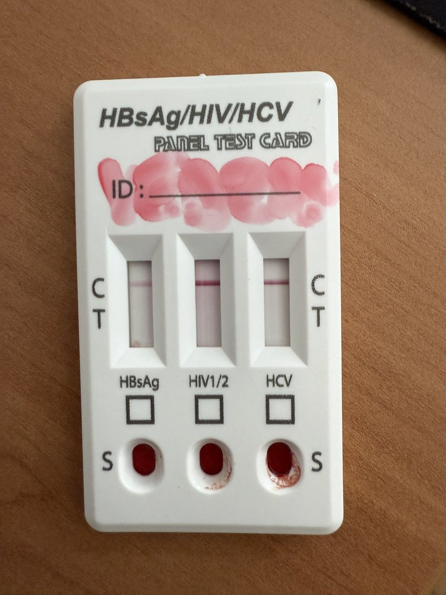 vedranmarcinko5's tweet image. Upravo obavljen test na HIV i hepatitise B i C, ljudi testirajte se!!!! Prevencija je ključna!