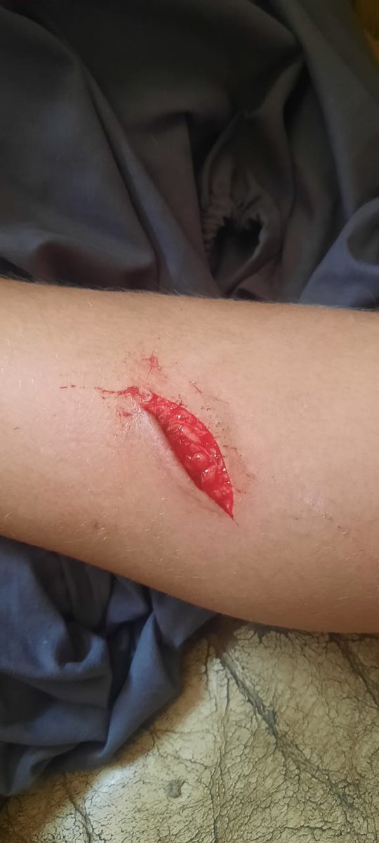 _ArriveAlive's tweet image. Treatment of and Response to Cuts and Bruises
ow.ly/dFbs50ufHMU
#ArriveAlive #Cuts #Bruises
@BurnshieldZA @LevtradeZA @HealthZA