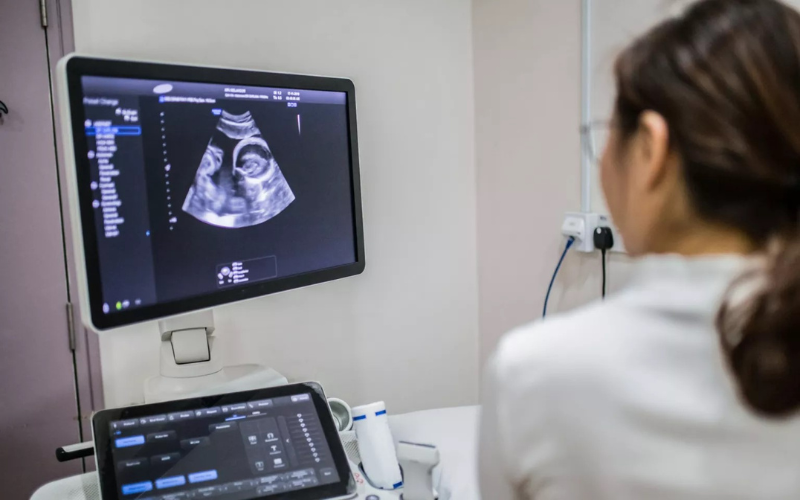 UCL_IfWH's tweet image. 📢 Apply to our IfWH BAME Master's / PhD Scholarship 2025.
Master's Scholarship has one award available, with £10,000 towards tuition fees.
PhD Scholarship offers £5,000 per year for 3 years towards tuition fees.
📅 Deadline: 31 July 2025
Apply now: bit.ly/3TNrvhN