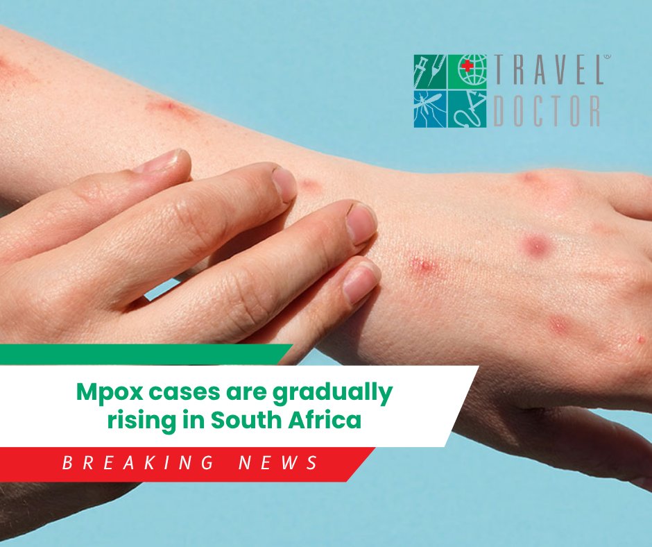 TrvlDoc's tweet photo. 📢 Mpox Update
Two new cases confirmed in South Africa—one in Cape Town, one in Johannesburg. Neither patient had recent travel history. 💉 Vaccines are now available at Travel Doctor Corporate.

Book your vaccine and stay protected: https://t.co/HLoTaeFqbR

#MpoxAwareness https://t.co/LCNng5odqj