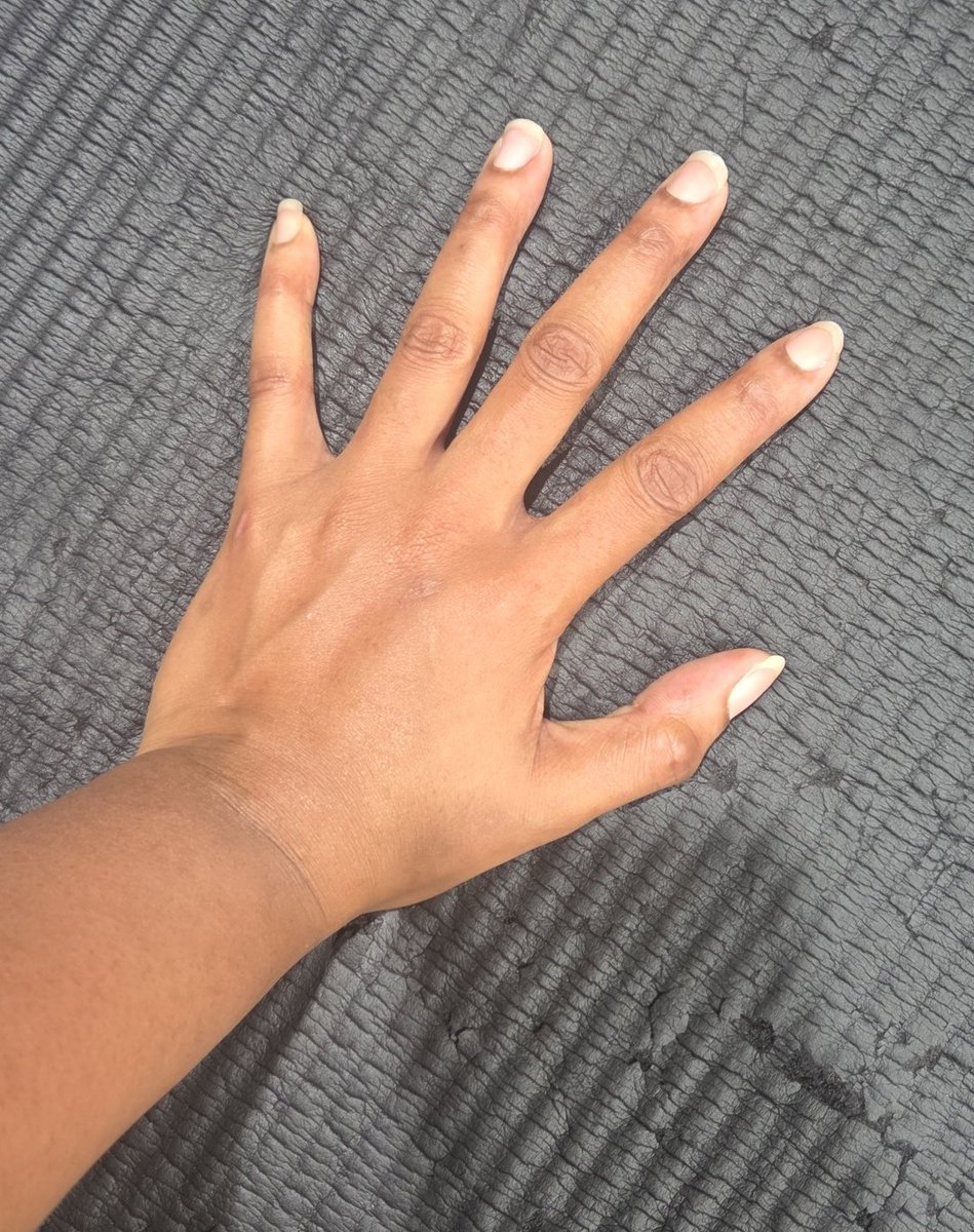 ThePinkLady0's tweet photo. Going into my planks and I was like "maybe it's time for a nail cut?" #tinypaws https://t.co/oEYFB3IGak