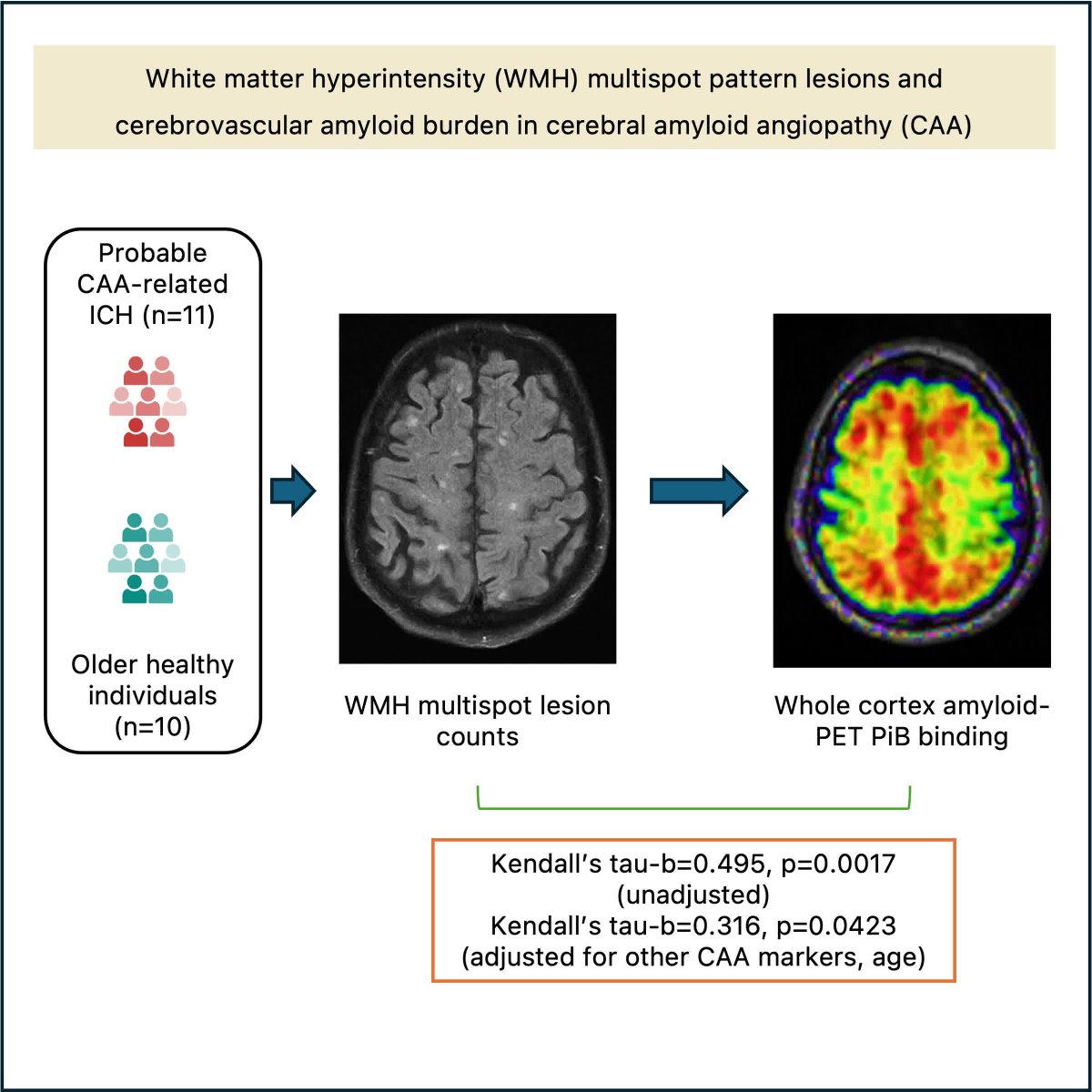 StrokeAHA_ASA's tweet image. #STROKE: A pilot study suggests a positive association between cerebrovascular amyloid deposition and white matter hyperintensity multispot lesions in CAA, with potential pathophysiological and clinical implications. @a_charidimou @BUMedicine #AHAJournals ahajrnls.org/4f5CUDi