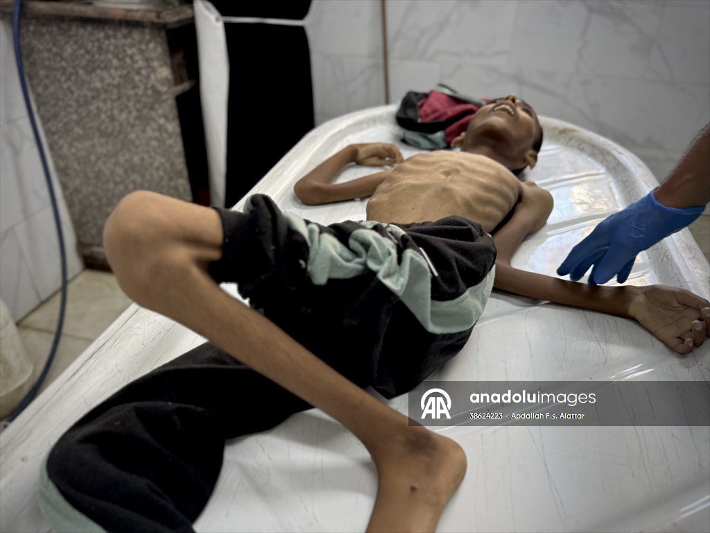 abdallahatar's tweet image. صور الطفل الفلسطيني عبد الجواد الغلبان البالغ من العمر 14 عاما، الذي فقد حياته بسبب سوء التغذية في خان يونس.
تصوير | عبدالله العطار
