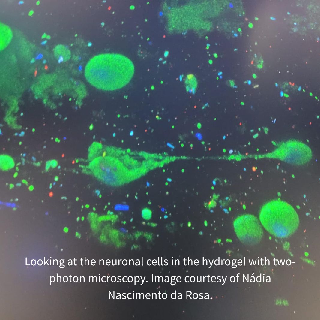 EuroBioImaging's tweet image. Using #imaging technologies at our AMMI Node in Maastricht, Nádia Nascimento da Rosa evaluates bioprinted neurons in the search for new therapies for #ParkinsonsDisease.
#WorldBrainDay
eurobioimaging.eu/news/internati…