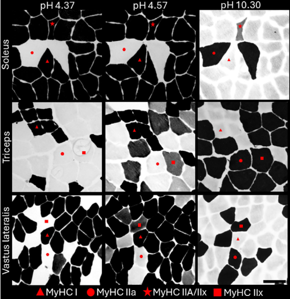 Soendenbroe's tweet image. 1/4
Muscle is great — but which muscle should you study? 💪
Our new paper shows that the soleus has uniquely large, irregular, and variable fibres — in both humans and mice!
We quantified this using the Shape Factor Index (SFI): Method here: onlinelibrary.wiley.com/doi/full/10.10…
🧵