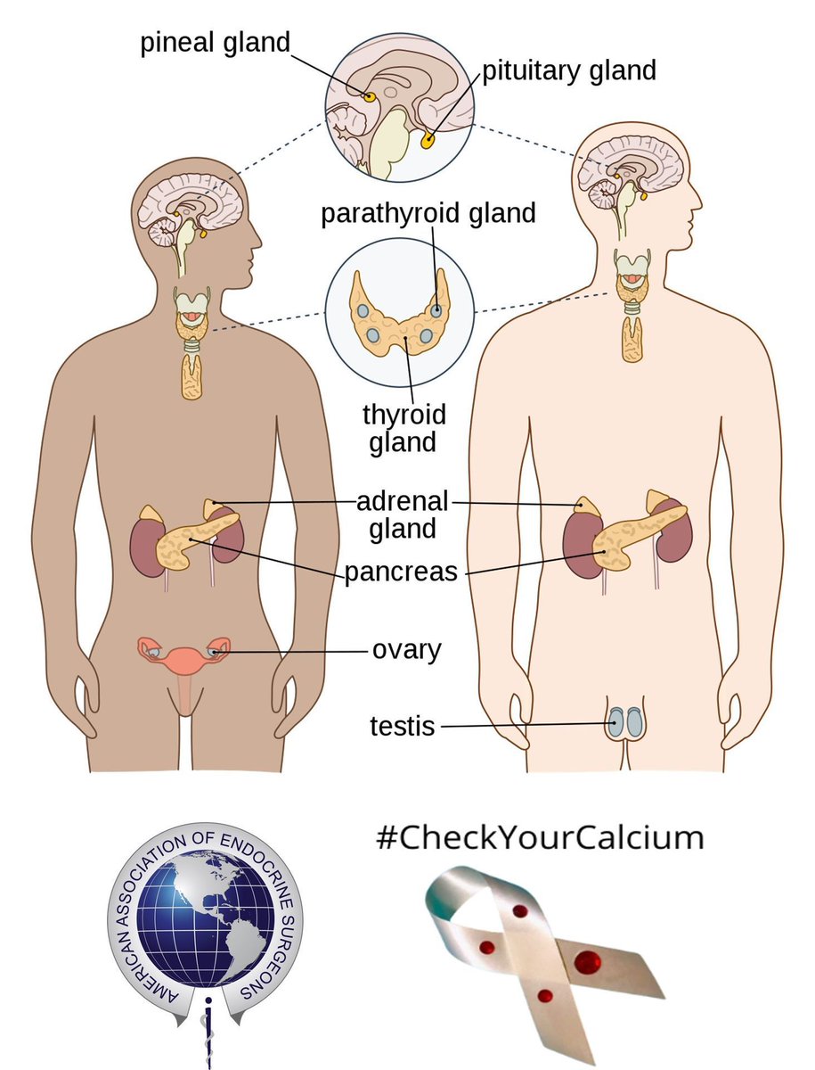 TheAAES's tweet image. 🧬 Is Primary Hyperparathyroidism Hereditary?
In most cases, primary hyperparathyroidism is not inherited—meaning it doesn’t run in families. Many patients have no family history of the condition and no involvement of other hormone-producing glands. #PAM2025 #CheckYourCalcium