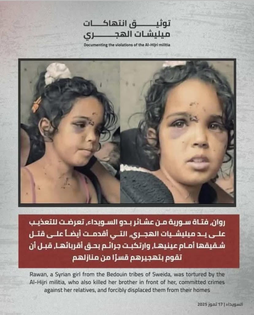 omar_alharir's tweet image. روان التي تركت ميليشيات الهجري ندبة في وجهها الجميل وفي ذاكرتها .. روان التي لن يذكرها اعلام الكذب وفلول النظام فهي ليست من أقلياتهم