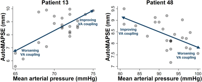 dritsyk's tweet photo. 🫀How can we use continuous #AutoMAPSE to optimize hemodynamics and VA coupling? Perhaps by balancing #MAPSE with MAP⚖️.
🧵Why is this useful?
📜🚨In our paper just published in @JcmcSoMe: pts have individual #MAPSE/MAP-relationships: https://t.co/Qi054feGfB
#POCUS #EchoFirst https://t.co/rmccWMvfso