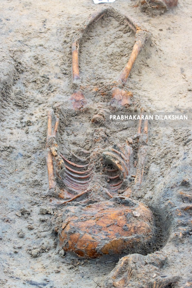 Prabhakaranlk's tweet image. யாழ்ப்பாணம் - செம்மணி மனிதப் புதைகுழியின் இன்றைய அகழ்வின் போது சிசுக்களின் என்புத் தொகுதி மற்றும் சிறுவர்களின் என்புத் தொகுதிகள் என சந்தேகிக்கப்படும் என்புத்தொகுதிகள் உட்பட எட்டு என்புத் தொகுதிகள் புதிதாக அடையாளம் காணப்பட்டன.
#chemmani #chemmanimassgrave #Jaffna