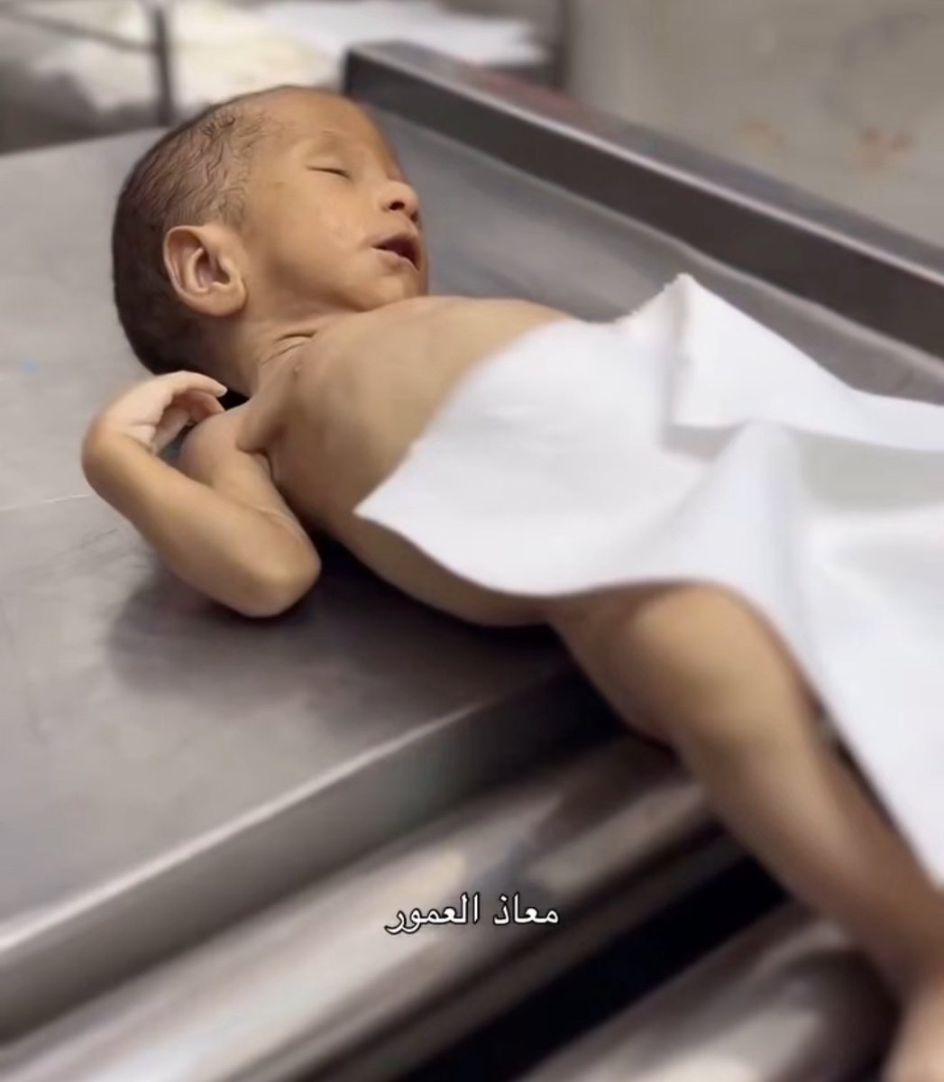 MosabAbuToha's tweet image. Yousef Mohammad al-Safadi, 40 days old, died of malnutrition today.