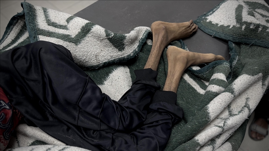 Puntlandmirror's tweet image. The World Food Program (WFP) warns that #Gaza is facing an unprecedented hunger crisis due to the ongoing #Israeli blockade.
One-third of the population has gone without food for several days, and a quarter is experiencing famine-like conditions. Around 100,000 women and…