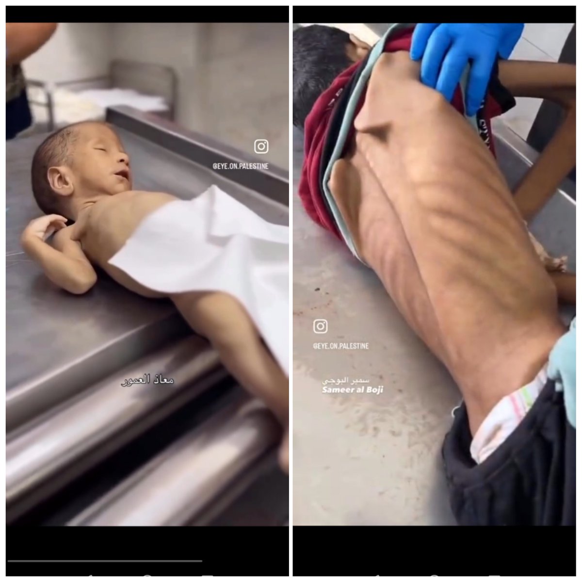 yugovaz's tweet image. Ya que no vamos a hacer nada por detener el exterminio. Que al menos, las imágenes de los niños muertos perturben nuestros sueños.
Esto sucede porque nostros callamos.