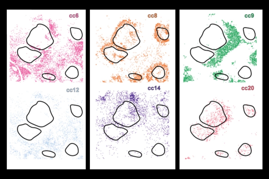 ScienceinBoston's tweet image. Researchers at @MIT, @ragoninstitute, and the @broadinstitute have developed a new deep learning AI tool called CellLENS.
CellLENS reveals hidden patterns in cell behavior within tissues, offering insights into cell heterogeneity: bit.ly/4m1Oq52
#CancerImmunotherapy