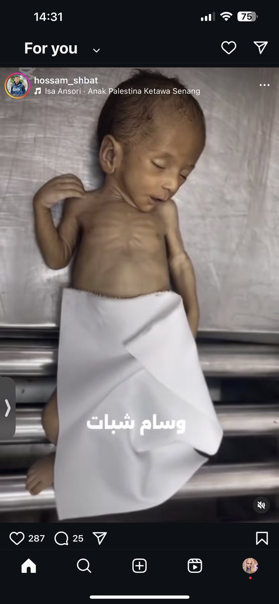 Ontheboldstep's tweet image. He died because he had no formula. Starved to death at 40 days old by @Israel @IDF @netanyahu @IsraeliPM Zionists are the 21st century Nazis!!!! @Alan__Shatter