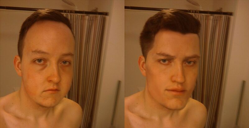 ChangVSWoke's tweet image. A few millimeters of bone can change your life forever.