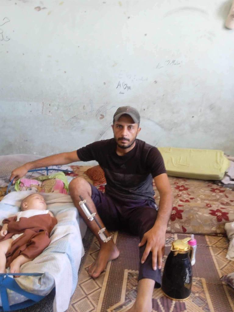 abu_hafed1's tweet image. My friend Ashraf... injured and unable to find food for his children.
Amidst the pain and siege, there is a faint voice crying out in the pain of helplessness and poverty... It is the voice of my friend Ashraf, who suffered a serious injury to his feet, rendering him unable to…