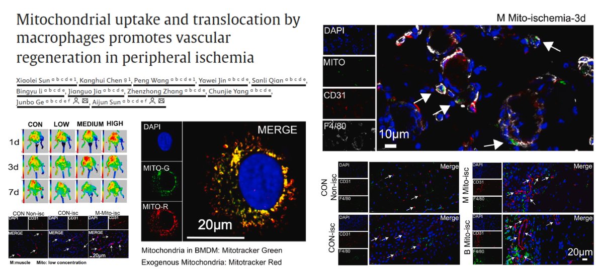 HaoYin20's tweet image. (Mouse/Human) Mitochondria transplantation i.m. improves reperfusion #Angiogenesis of 🐭#LimbIschemia
Macrophage, instead of #EndothelialCell, is the major cell type that internalizes exogenous Mitochondria (sustained by day 3 not 7)
⏫M2-like polarization in…