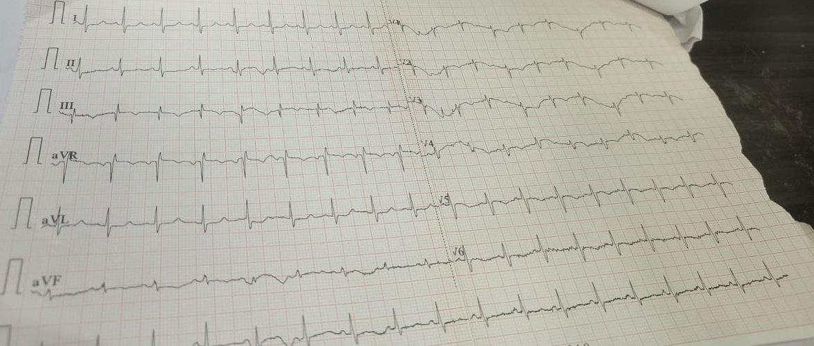 <a href="/Ecgloverr/">Pedram</a> 
<a href="/ecgandrhythmRoe/">Dr. Andreas Roeschl</a> 
<a href="/ECG_BUDDY_ARPI/">ECG Buddy</a> 
<a href="/ecgrhythms/">Arnel Carmona</a> 
<a href="/EcgOxford/">🫀EcgOxford</a> 
<a href="/smithECGBlog/">Stephen W. Smith</a>