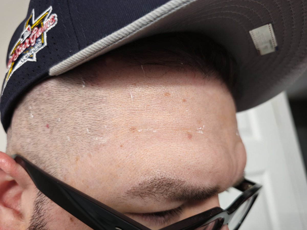 Chf_BoyarB's tweet photo. Excuse me @NewEraCap, but I'm not sure putting screen printed stars inside of the hat on the Sweatband was a good idea. Could I possibly get a refund, since the starts literally melt when they are on your head? https://t.co/voHQcZd70R
