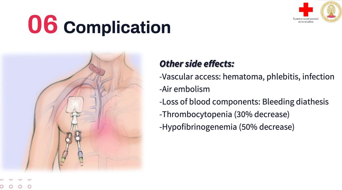 manopsi's tweet image. อ.ปอนด์ แชร์ความเสี่ยงต่อการทำ plasmapheresis ที่สำคัญ
1. หัตถการผิดพลาด = เส้นเลือดฉีก เลือดออก ติดเชื้อ & air embolism 😨
2. เลือดออกผิดปกติ ทำแต่ละครั้งเกล็ดเลือด, coagulation factors, fibrinogen หายไป 30-50% ใช้เวลา 72 ชม.กว่าจะสร้างทดแทน
3. Citrate…