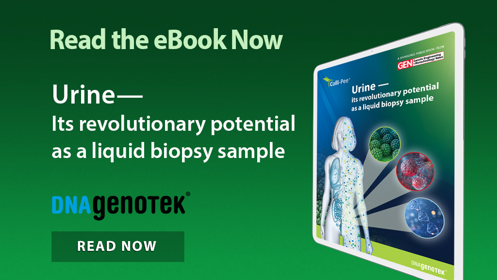 GENbio's tweet image. Don't miss this new eBook! This eBook aims to provide a comprehensive overview of first-void urine as a sample type, highlighting its advantages, challenges, and future prospects. Download this free ebook sponsored by @dnagenotek: hubs.li/Q03vjTJ80