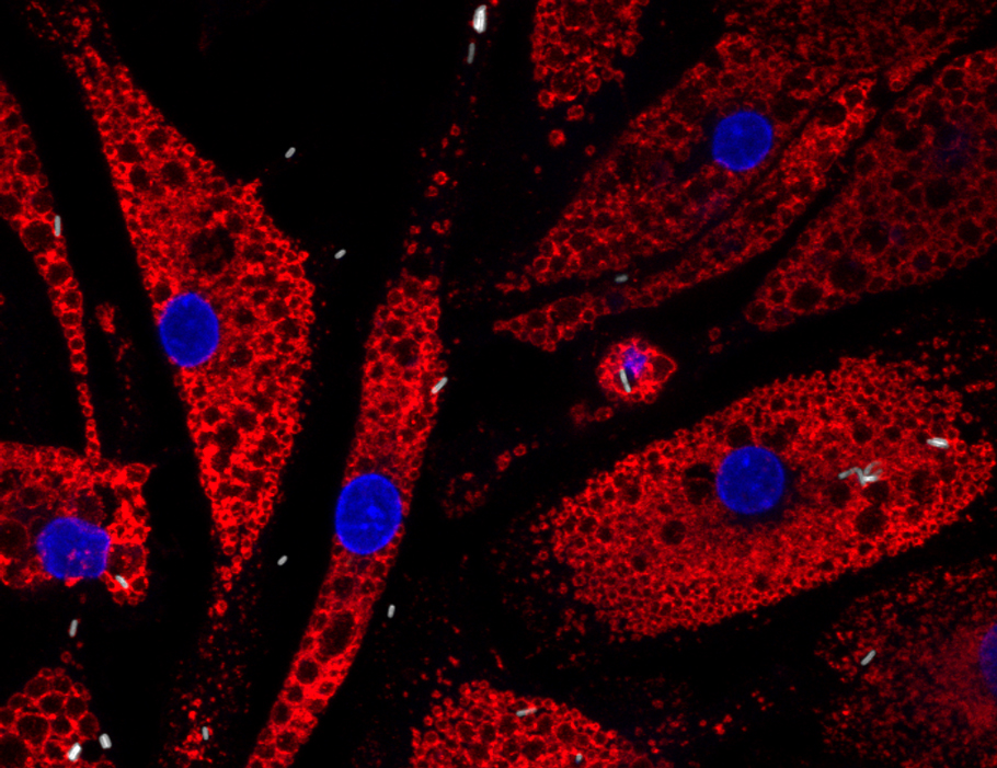 ScienceMagazine's tweet image. A new @SciImmunology study describes how the relative antimicrobial activity of #Hofbauer cells, or placental macrophages, diminishes during pregnancy, correlating with increased susceptibility to #listeriosis. scim.ag/3GTC285