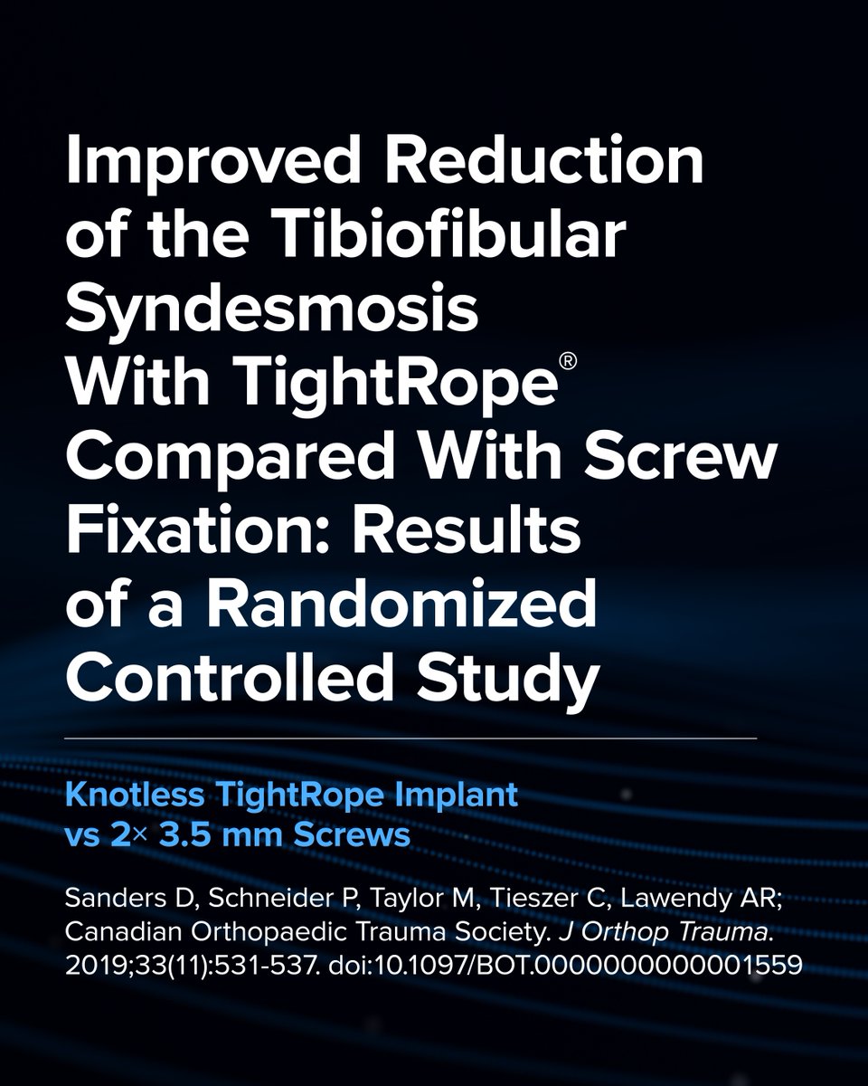 ArthrexMedEd's tweet image. This study compared the rate of malreduction after high fibular fractures associated with syndesmosis injury treated with open reduction and internal fixation using either 2 screws or the Knotless TightRope® implant. The study found that the TightRope device compared favorably to…