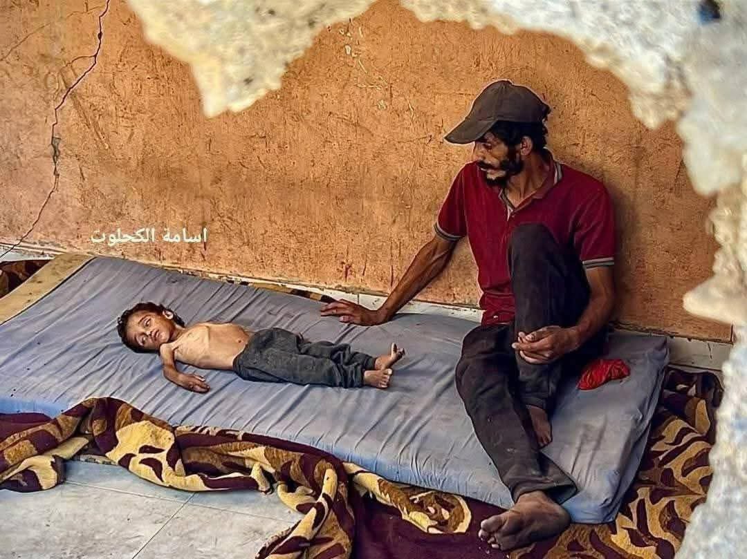 mhdksafa's tweet image. This photo needs to be the front page of every news paper in the world.
Malnourished children in Gaza.