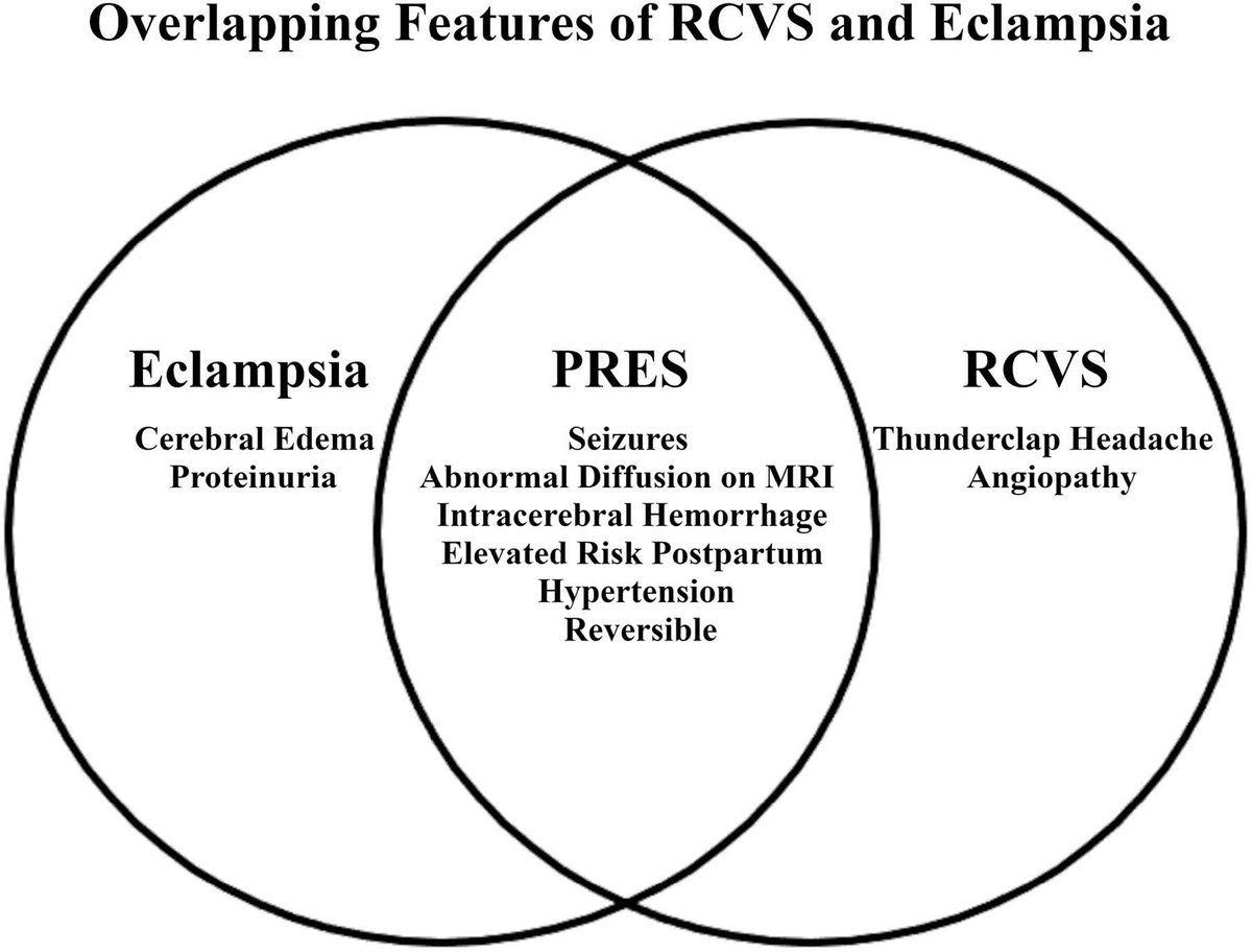 StrokeAHA_ASA's tweet image. Illustrative teaching case showcases the interplay between PRES and RCVS in pregnancy. #stroke #AHAJournals ahajrnls.org/3IDf6dH